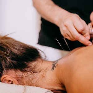 acupuncture-back-neck